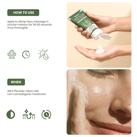 Anti Acne Face Wash