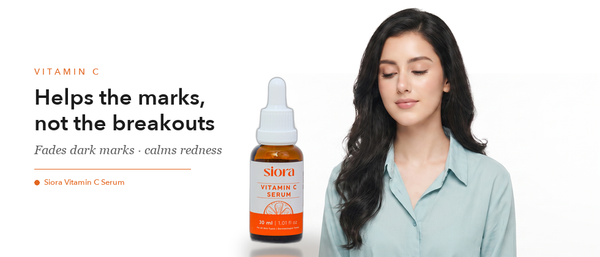 Vitamin C Serum for Acne: Does It Help or Make It Worse?