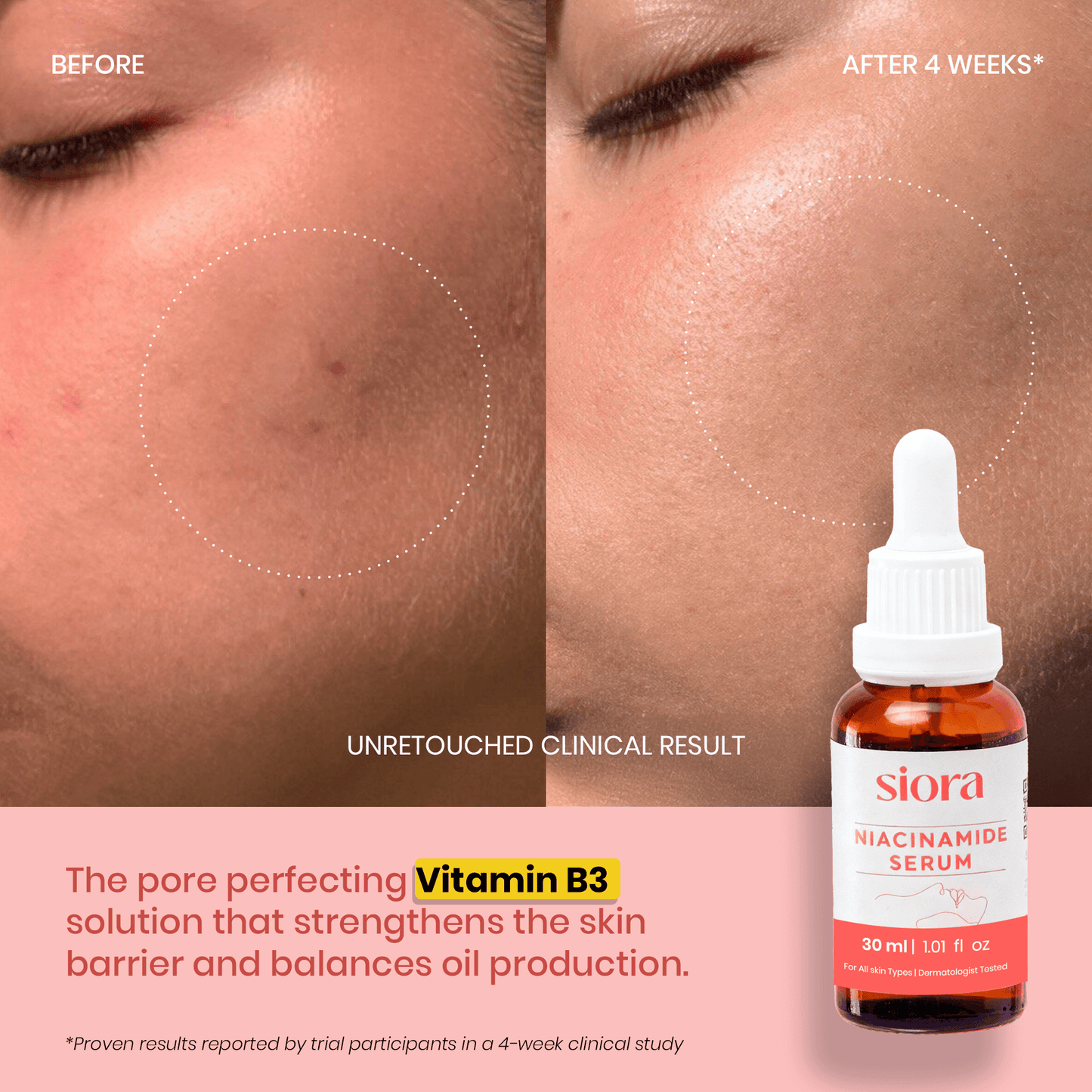 Niacinamide Serum