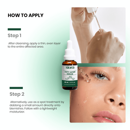 Anti Acne Serum